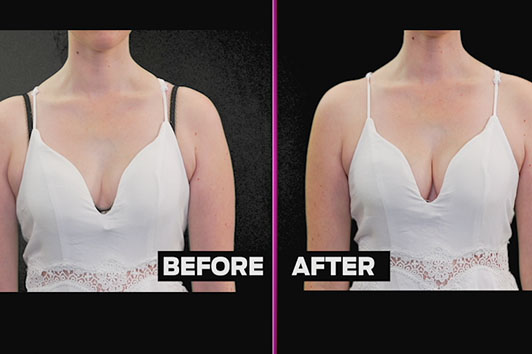 The hidden boost bra gives you a hot body and great shape and curves